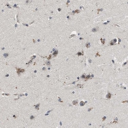 Pyruvate Dehydrogenase Phosphatase/PDP1/PPM2C Antibody, Novus Biologicals